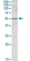 Anti-ALDH9A1 Goat Polyclonal Antibody