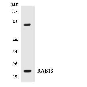 Western blot analysis of the lysates from HepG2 cells using Anti-RAB18 Antibody