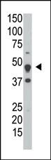 Anti-DUSP6 Rabbit Polyclonal Antibody