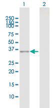 Anti-CDK5 Rabbit Polyclonal Antibody