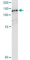 Anti-HIP1R Polyclonal Antibody Pair