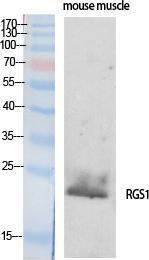 Western blot analysis of various cells using Anti-RGS1 Antibody