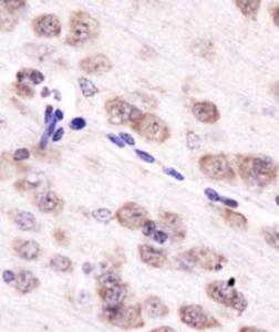 Anti-AURKA Rabbit Polyclonal Antibody