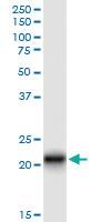 Anti-CLDN14 Rabbit Polyclonal Antibody