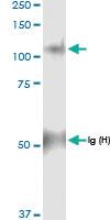 Anti-PYGL Rabbit Polyclonal Antibody