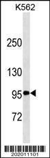 Anti-TNFRSF8, CD30 Mouse Monoclonal Antibody [clone: 595CT15.5.1]