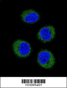 Anti-FGR Rabbit Polyclonal Antibody (AP (Alkaline Phosphatase))