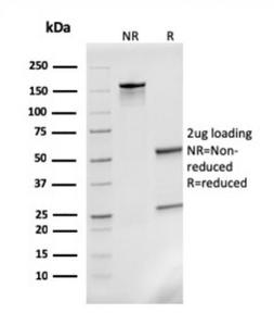 Anti-MCP2 antibody