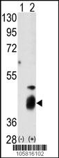 Anti-DUSP7 Rabbit Polyclonal Antibody