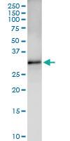 Anti-CDK5 Rabbit Polyclonal Antibody