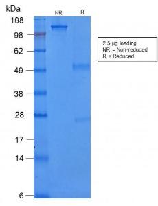 SDS-PAGE analysis of Anti-Cytokeratin 8 Antibody [rB22.1] under non-reduced and reduced conditions; showing intact IgG and intact heavy and light chains, respectively. SDS-PAGE analysis confirms the integrity and purity of the antibody.