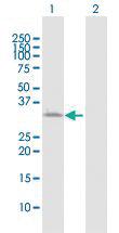 Anti-ATP1B3 Rabbit Polyclonal Antibody