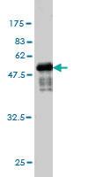 Anti-TPSAB1 Mouse Monoclonal Antibody [clone: 2A10-B5]