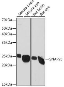 Western blot analysis of extracts of various cell lines, using Anti-SNAP25 Antibody [ARC0736] (A308074) at 1:1,000 dilution