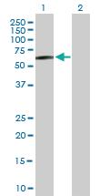 Anti-STK33 Mouse Polyclonal Antibody