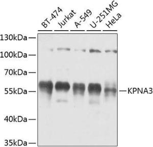 Western blot analysis of extracts of various cell lines, using Anti-KPNA3 Antibody (A12240) at 1:1,000 dilution