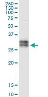 Anti-ATP1B3 Rabbit Polyclonal Antibody