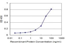 Anti-PKP4 Mouse Monoclonal Antibody [clone: 1B11]