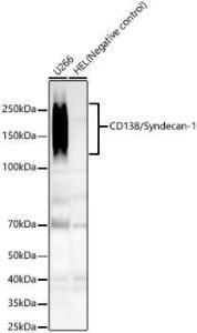 Anti-Syndecan-1 Rabbit Monoclonal Antibody [clone: ARC60160]