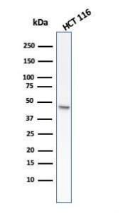 Western blot analysis of HCT116 cell lysate using Anti-Cytokeratin 8 Antibody [rB22.1]