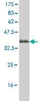 Anti-MCCC1 Mouse Monoclonal Antibody [clone: 2G8]