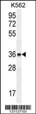 Anti-ETV2 Rabbit Polyclonal Antibody