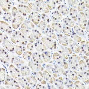 Immunohistochemistry analysis of paraffin-embedded rat stomach using Anti-KPNA3 Antibody (A12240) at a dilution of 1:100 (40X lens). Perform high pressure antigen retrieval with 10 mM citrate buffer pH 6.0 before commencing with IHC staining protocol