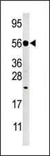 Anti-DUSP8 Rabbit Polyclonal Antibody