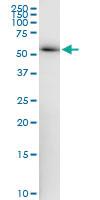 Anti-ZNF622 Polyclonal Antibody Pair