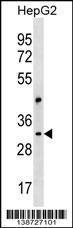 Anti-CEP170L Rabbit Polyclonal Antibody (Biotin)