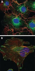 Anti-LPP Mouse Monoclonal Antibody [clone: 8B3A11]