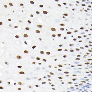 Immunohistochemistry analysis of paraffin-embedded human esophageal using Anti-KPNA3 Antibody (A12240) at a dilution of 1:100 (40X lens). Perform high pressure antigen retrieval with 10 mM citrate buffer pH 6.0 before commencing with IHC staining protocol