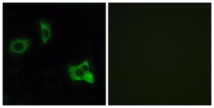 Immunofluorescence analysis of MCF7 cells using Anti-OXER1 Antibody. The right hand panel represents a negative control, where the antibody was pre-incubated with the immunising peptide