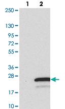 Anti-TMEM138 Rabbit Polyclonal Antibody