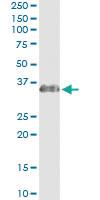 Anti-ECHS1 Antibody Pair