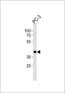 Anti-CREB3L4 Rabbit Polyclonal Antibody