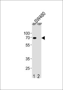 Anti-ETV5 Rabbit Polyclonal Antibody (AP (Alkaline Phosphatase))