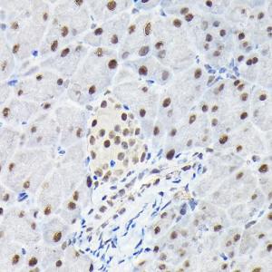 Immunohistochemistry analysis of paraffin-embedded mouse pancreas using Anti-KPNA3 Antibody (A12240) at a dilution of 1:100 (40X lens). Perform high pressure antigen retrieval with 10 mM citrate buffer pH 6.0 before commencing with IHC staining protocol