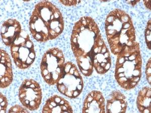 Immunohistochemical analysis of formalin-fixed, paraffin-embedded human colon using Anti-Cytokeratin 8 Antibody [rKRT8/4209]