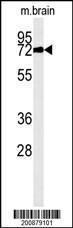 Anti-TNK1 Mouse Monoclonal Antibody [clone: 170CT7.5.4]