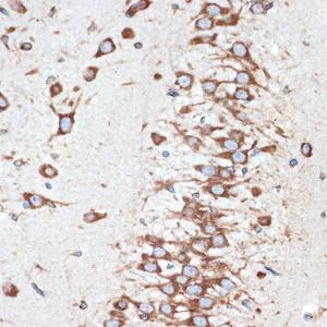 Immunohistochemistry analysis of paraffin-embedded rat brain using Anti-LMAN1 Antibody [ARC1978] (A306904) at a dilution of 1:100 (40X lens). Perform microwave antigen retrieval with 10 mM Tris/EDTA buffer pH 9.0 before commencing with IHC staining protocol