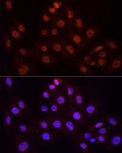 Immunofluorescence analysis of H9C2 cells using Anti-KPNA3 Antibody (A12240) at a dilution of 1:100 (40X lens). DAPI was used to stain the cell nuclei (blue)