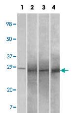 Anti-RAB25 Mouse Monoclonal Antibody [clone: 3F12F3]