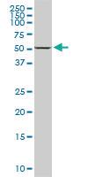 Anti-DDX56 Mouse Monoclonal Antibody [clone: 6B9]