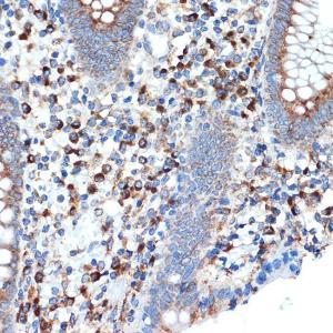 Immunohistochemistry analysis of paraffin-embedded human appendix tissue using Anti-LMAN1 Antibody [ARC1978] (A306904) at a dilution of 1:100 (40X lens). Perform microwave antigen retrieval with 10 mM Tris/EDTA buffer pH 9.0 before commencing with IHC staining protocol