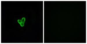 Immunofluorescence analysis of LOVO cells using Anti-PTAFR Antibody. The right hand panel represents a negative control, where the antibody was pre-incubated with the immunising peptide.