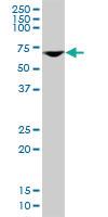 Anti-DDX56 Mouse Monoclonal Antibody [clone: 6B9]