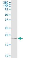 Anti-NDUFB6 Polyclonal Antibody Pair