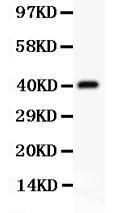 Anti-CD3 Epsilon Polyclonal Antibody