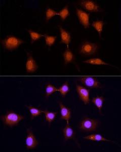 Immunofluorescence analysis of L929 cells using Anti-KPNA3 Antibody (A12240) at a dilution of 1:100 (40X lens). DAPI was used to stain the cell nuclei (blue)